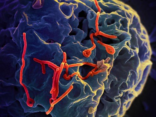 Ebola Hematologic Disorders: Uganda Outbreak Highlights Gaps