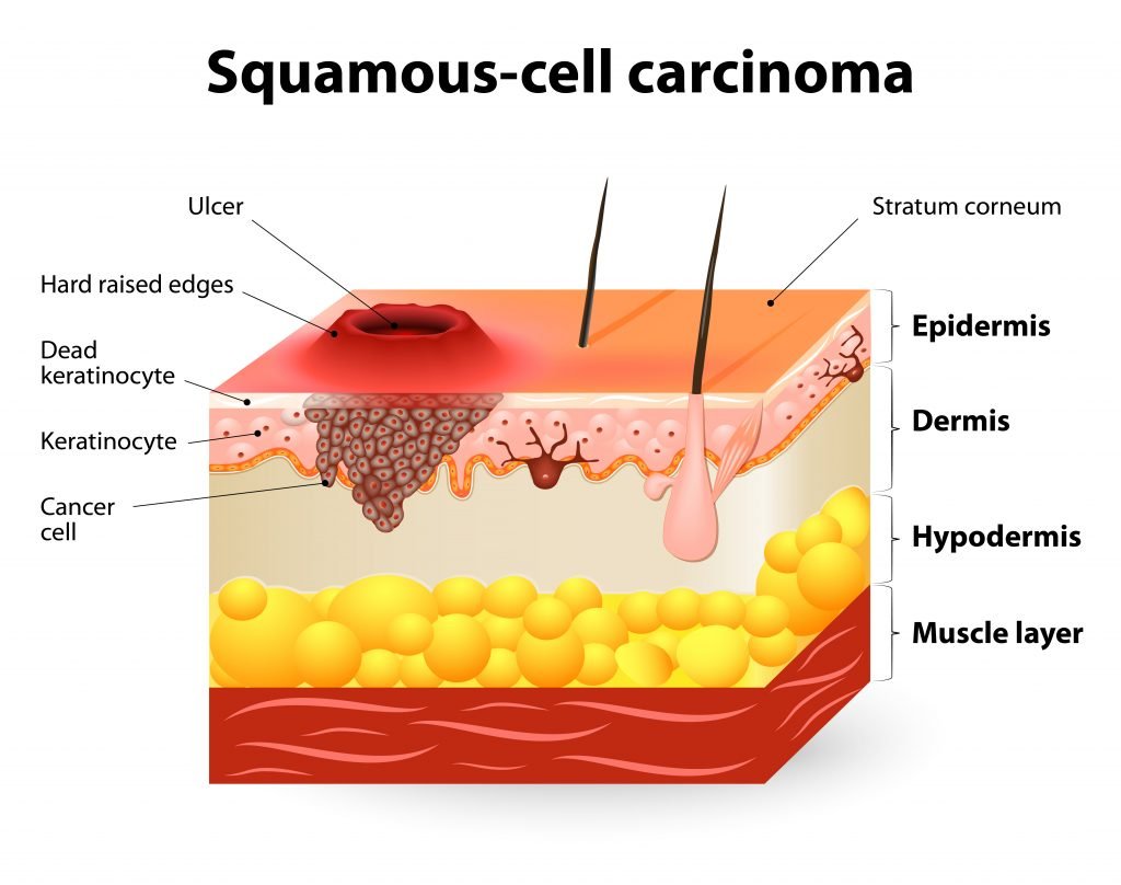 John Cena Reveals Skin Cancer Battle