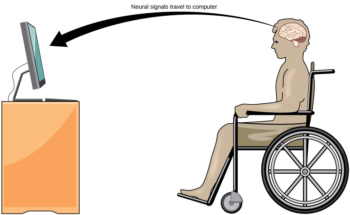 Neuralink's Brain Chip Implant: First Human Trial Success